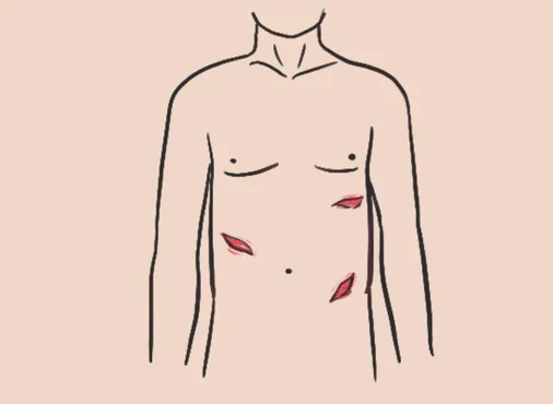 Abdominal Trauma consultation at Niraaya Hospital